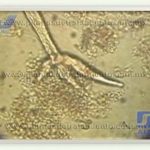 Bacteria-aerobia-de-planta-de-tratmiento-asa-jet